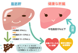 肝 は 脂肪 と